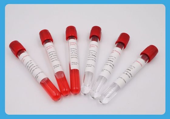 5ml Tabung Pengumpul Sampel Benang Khusus Ethylene Oxide